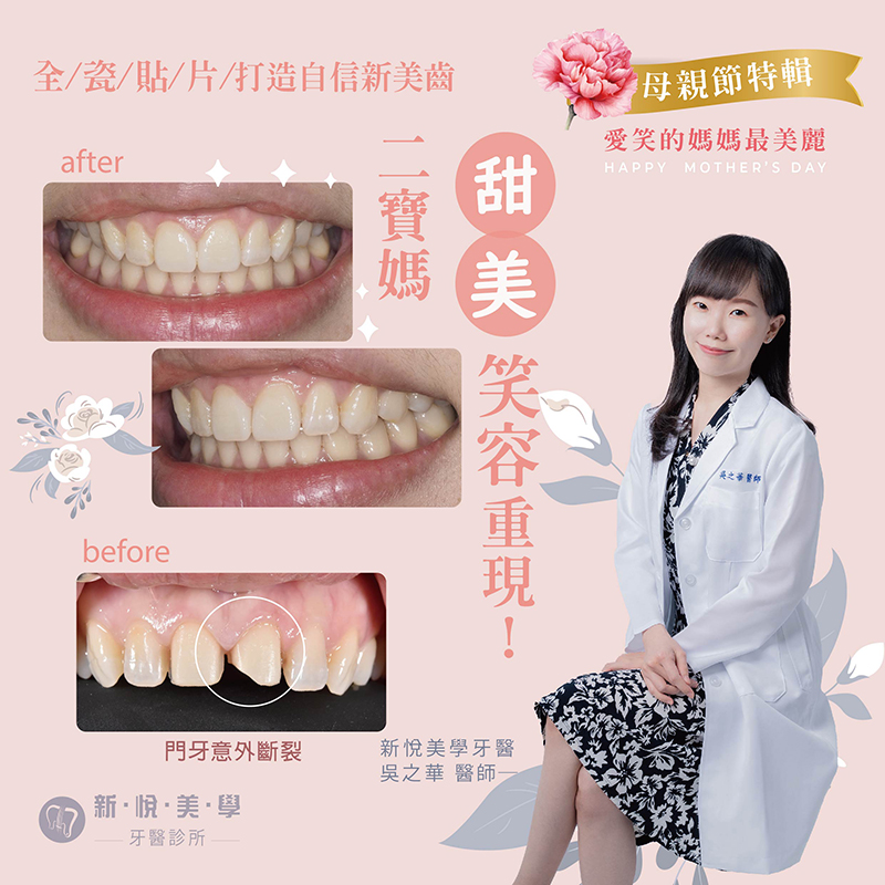 新悅美學牙醫診所的案例分享圖片